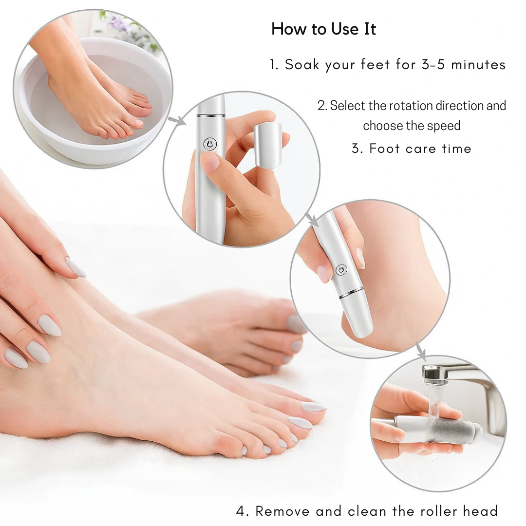 Levigatore elettrico per calli dei piedi