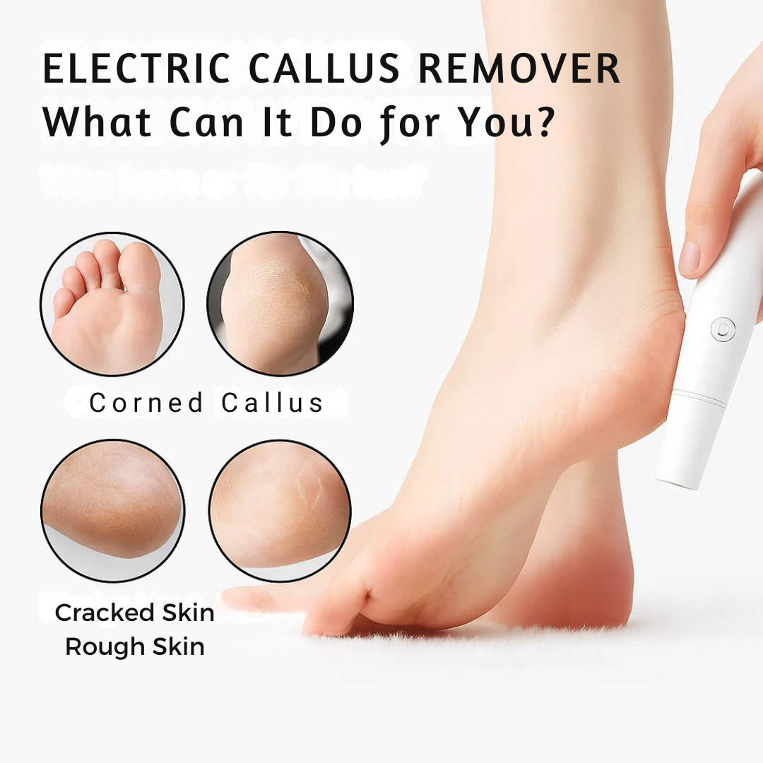 Levigatore elettrico per calli dei piedi