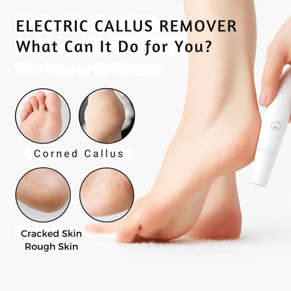Levigatore elettrico per calli dei piedi