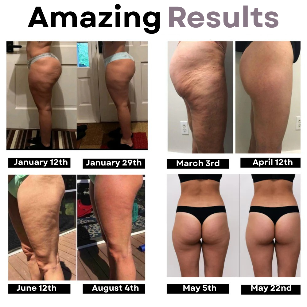 LINA - Cellulite-Reducing Leggings