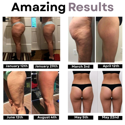 LINA - Cellulite-Reducing Leggings